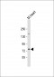 SLC6A8 Antibody (N-Term)