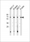 FEM1B Antibody (C-Term)