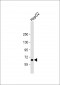 LSR Antibody (N-Term)