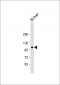 GART Antibody (C-Term)