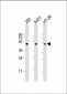 p53 Antibody (S15)