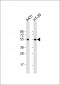 p53 Antibody (S315)