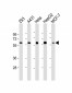 p53 Antibody (S315)