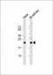 DJ-1 Antibody (N-term)