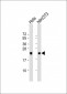 DJ-1 Antibody (N-term)