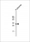 HPGD Antibody (C-term)