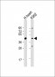 PDK4 Antibody (C-term)