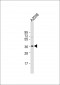 IGHA1 Antibody (C-term)