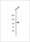 DDR1 Antibody (N-term)