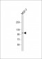 DDR1 Antibody (N-term)