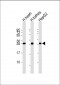 AK2 Antibody (C-term)