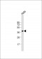 ARPC1B Antibody (Center)