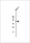 TGOLN2 Antibody (C-term)