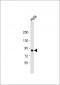 TGM2 antibody ( Ascites)