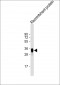 LRP1B Antibody
