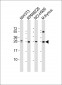 FGFR1OP2 Antibody