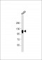 CYLD Antibody