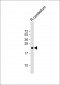 CD81 Antibody