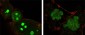 Nucleophosmin Antibody