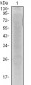 IL-8 Antibody