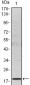 IL-6 Antibody