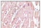 cTnI Antibody