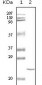 cTnI Antibody