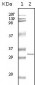 HPRT Antibody