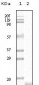 SNCG (breast cancer-specific protein 1) Antibody