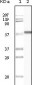 CK1 Antibody