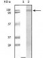 Tyk2 Antibody