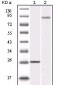 IKBKB Antibody