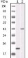 AURKB Antibody