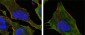 S100A10/P11 Antibody