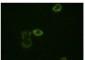 ABL2 Antibody