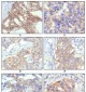 HER-2 Antibody