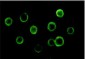 BTK Antibody