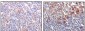 BTK Antibody