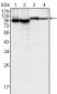 BTK Antibody