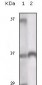 TYRO3 Antibody