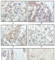 RSK1 Antibody