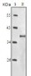 IGF1R-Beta Antibody