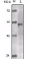 TIP60 Antibody