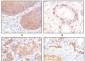 Cytokeratin 5 Antibody