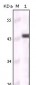 Cytokeratin 5 Antibody