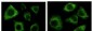 Cytokeratin (Pan) Antibody