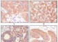 Cytokeratin (Pan) Antibody