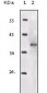 IGF1R-Beta Antibody