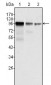 FER Antibody