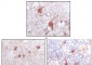 S100B Antibody